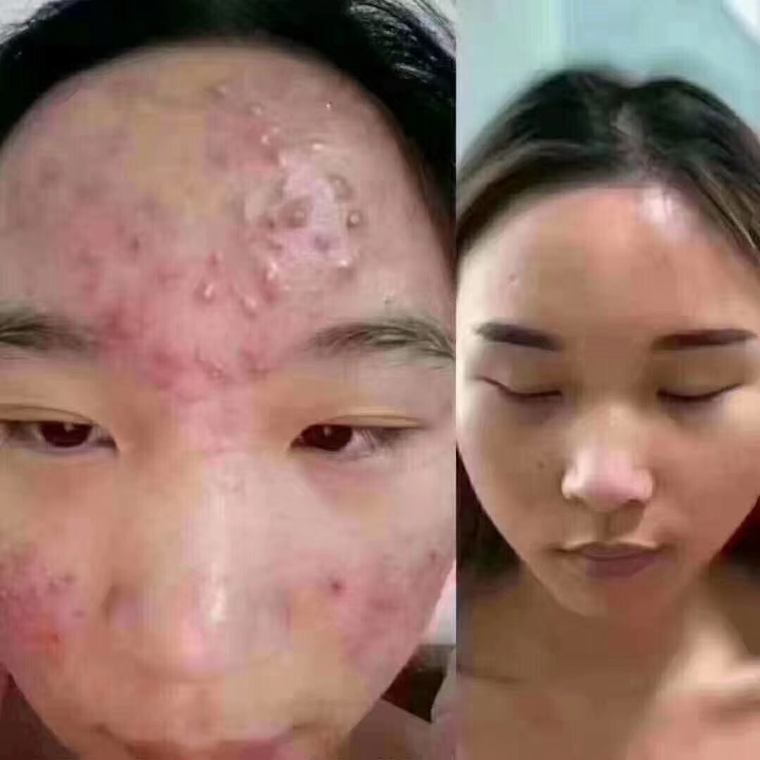 案例展示二十一
