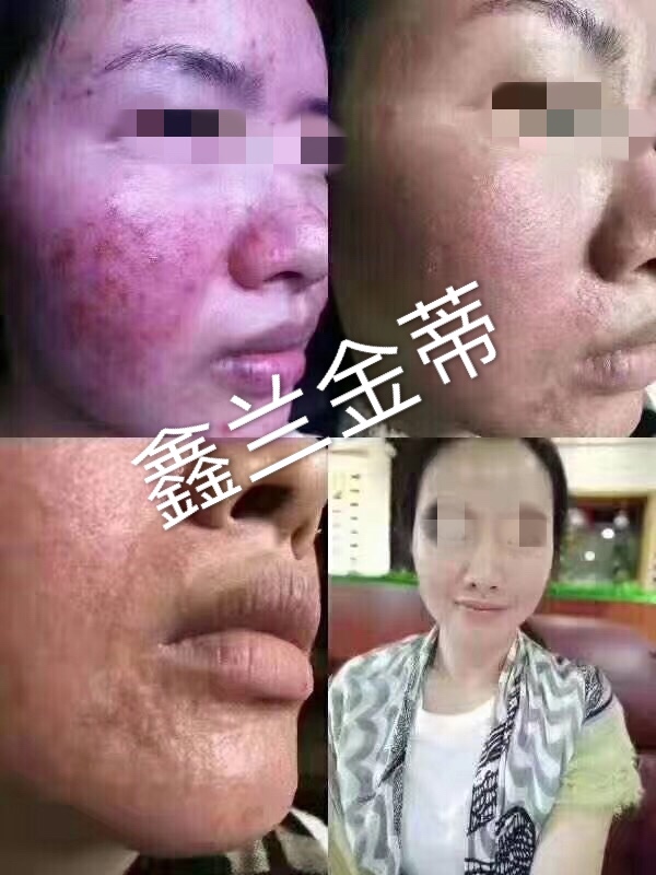 案例展示二十二