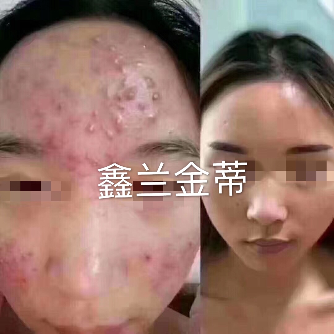 案例展示二十三